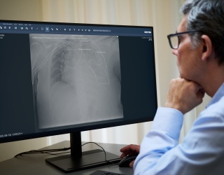 Foto: Sectra baut mit Oxipit autonome KI-Fähigkeiten in der aus...