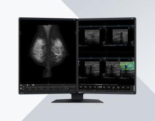 Foto: EIZO RadiForce-Line-up für die Mammographie